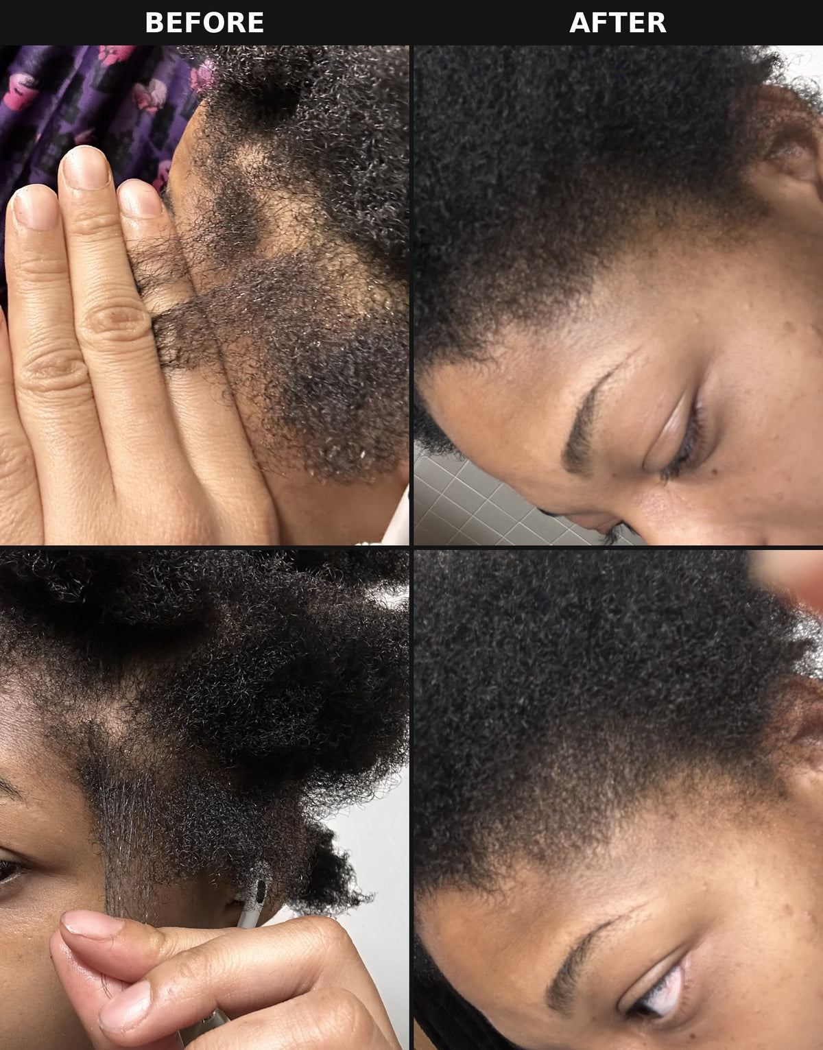 Before and after photo showing hair growth results from The Formula botanical hair oil