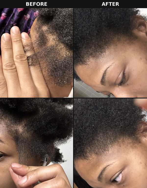 Before and after photo showing hair growth results from The Formula botanical hair oil